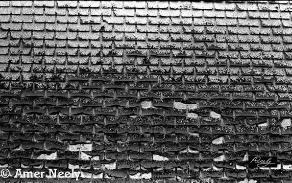 Shingles